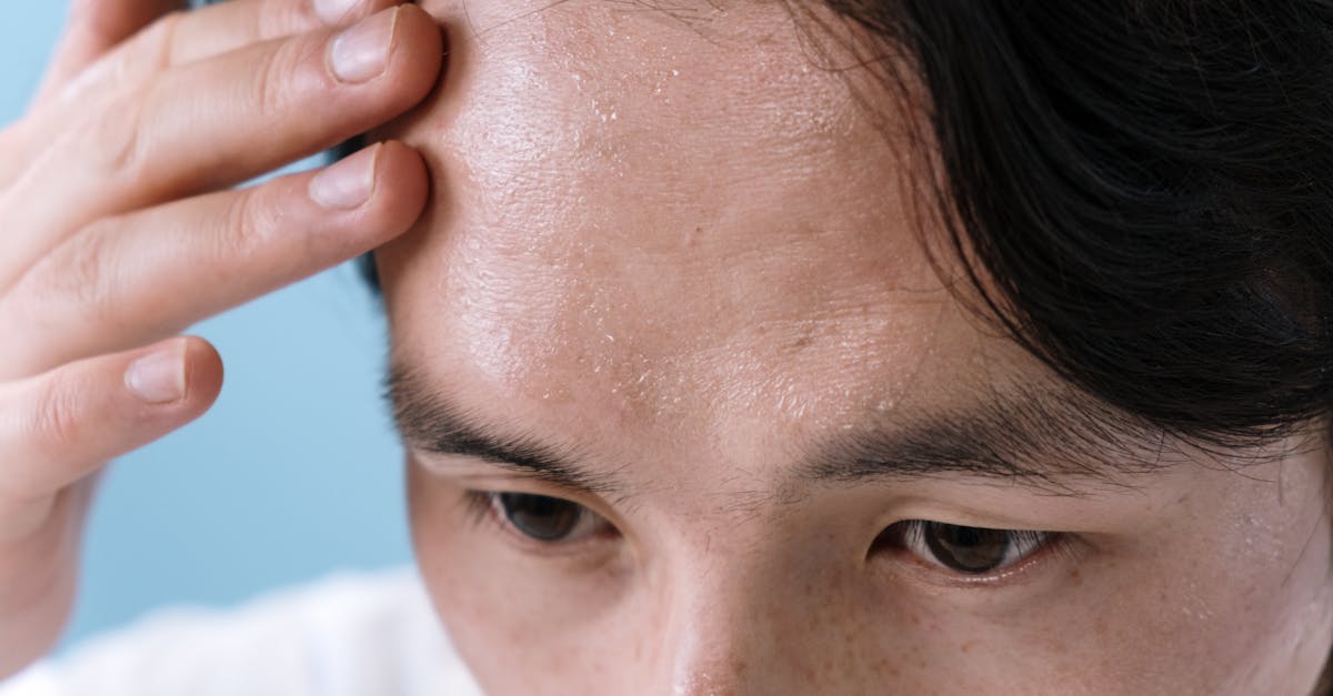 ¿Cuáles son los problemas oculares comunes y sus síntomas?