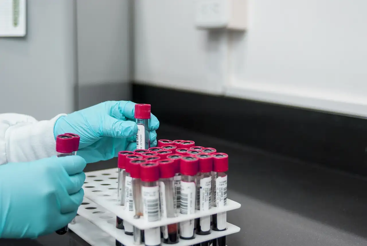 ¿Quién fue el descubridor del ureo en el laboratorio?